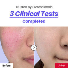 Calming Cream